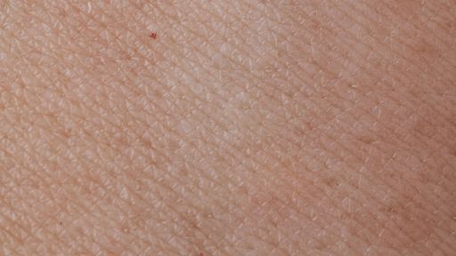 Comprendre pourquoi le psoriasis est une maladie inflammatoire et comment il se développe.