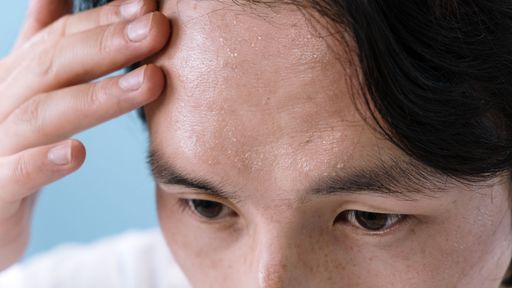 Migraine et chaleur : cet été, pas de prise de tête ! 